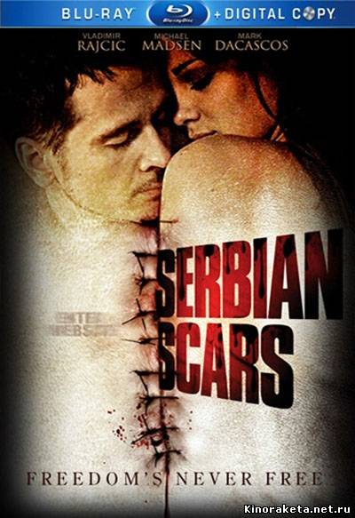 Шрам Сербии / Serbian Scars (2009) онлайн